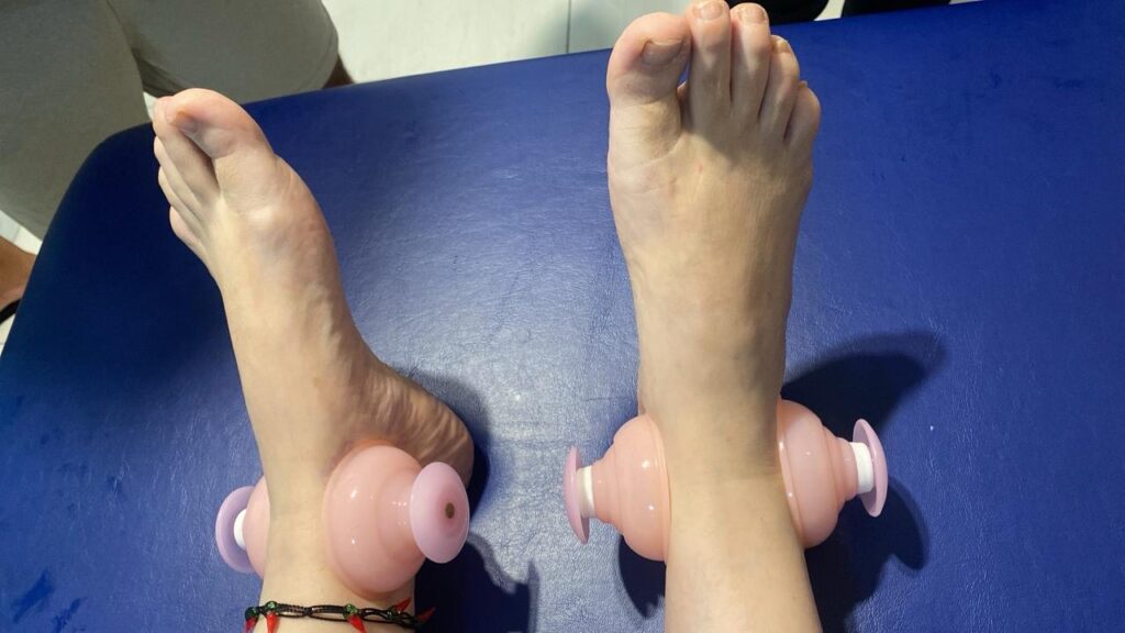 Ventosas de silicone aplicadas nos tornozelos