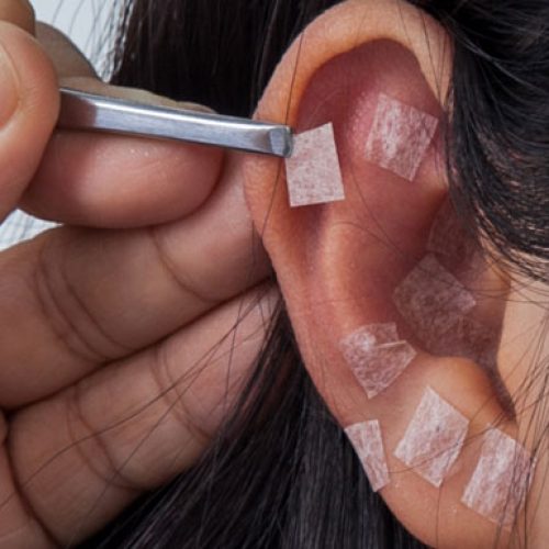 curso-Auriculoterapia-Chinesa​